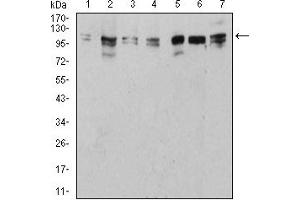 Image no. 3 for anti-Unc-51 Like Kinase 2 (ULK2) (AA 1-155) antibody (ABIN5882566)