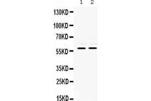 Image no. 1 for anti-Matrix Metallopeptidase 8 (Neutrophil Collagenase) (MMP8) (AA 119-153), (N-Term) antibody (ABIN3043882)