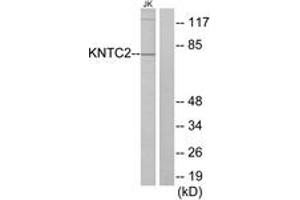 Image no. 1 for anti-NDC80 Kinetochore Complex Component Homolog (NDC80) (AA 351-400) antibody (ABIN1533486)