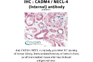 Image no. 1 for anti-Cell Adhesion Molecule 4 (CADM4) (Internal Region) antibody (ABIN1732540)