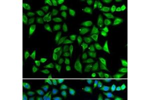 Immunofluorescence analysis of U2OS cells using DNAJA3 Polyclonal Antibody