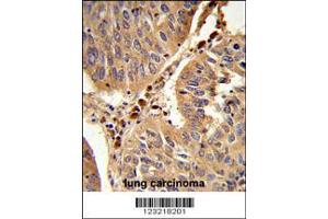 Image no. 3 for anti-Peroxisomal Biogenesis Factor 16 (PEX16) (Center) antibody (ABIN2492519)