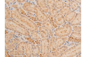 Image no. 10 for anti-Tumor Protein P73 (TP73) (pTyr99) antibody (ABIN6256817)