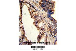 Image no. 2 for anti-Transglutaminase 4 (Prostate) (TGM4) (AA 135-164) antibody (ABIN390905)