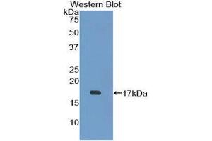 Image no. 1 for anti-T-Cell Leukemia/lymphoma 1A (TCL1A) (AA 6-112) antibody (ABIN1860691)