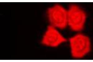 Image no. 1 for anti-Protein Kinase N1 (PKN1) (Center) antibody (ABIN2706821)