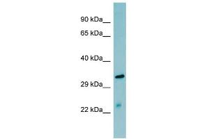 MASP2 antibody  (N-Term)