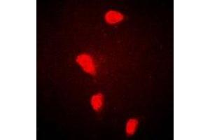 FHL1 anticorps