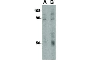 anti-CD248 Molecule, Endosialin (CD248) (C-Term) antibody