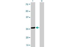Image no. 6 for anti-TGFB-Induced Factor Homeobox 2 (TGIF2) (AA 131-236) antibody (ABIN566207)
