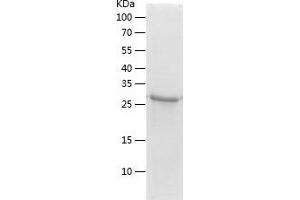 SULT4A1 Protein (AA 1-284) (His tag)