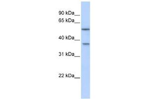 Image no. 1 for anti-RAB40B, Member RAS Oncogene Family (RAB40B) (Middle Region) antibody (ABIN634429)