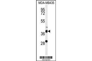 Western Blotting (WB) image for anti-Dehydrogenase/reductase (SDR Family) Member 7 (DHRS7) antibody (ABIN2158546)