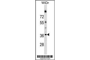 anti-Asparagine-Linked Glycosylation 5, Dolichyl-Phosphate beta-Glucosyltransferase Homolog (S. Cerevisiae) (ALG5) (AA 74-100) antibody