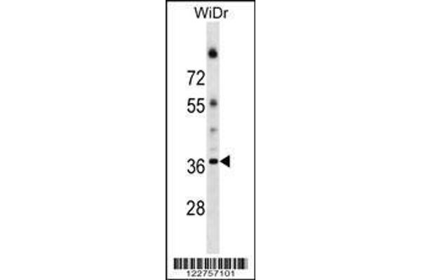 anti-Asparagine-Linked Glycosylation 5, Dolichyl-Phosphate beta-Glucosyltransferase Homolog (S. Cerevisiae) (ALG5) (AA 74-100) antibody