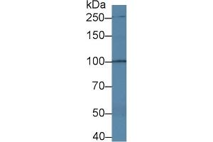 TRPC6 Antikörper  (AA 1-192)