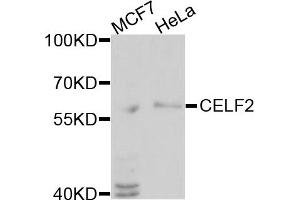 Image no. 2 for anti-CUGBP, Elav-Like Family Member 2 (CELF2) antibody (ABIN1877045)