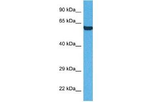 Image no. 2 for anti-Prolyl 4-Hydroxylase, beta Polypeptide (P4HB) (N-Term) antibody (ABIN2783245)