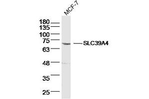 Image no. 1 for anti-Solute Carrier Family 39 (Zinc Transporter), Member 4 (SLC39A4) (AA 281-380) antibody (ABIN5675382)
