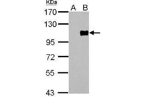 WB Image FOXM1 antibody [C3], C-term detects FOXM1 protein by Western blot analysis.