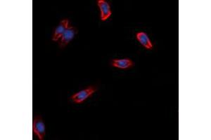 Image no. 2 for anti-G Protein-Coupled Receptor 97 (GPR97) (Center) antibody (ABIN2972477)