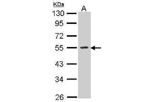 Image no. 3 for anti-Sphingosine Kinase 1 (SPHK1) (C-Term) antibody (ABIN2855922)