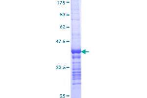 Image no. 1 for Ligase I, DNA, ATP-Dependent (LIG1) (AA 810-919) protein (GST tag) (ABIN1309400)