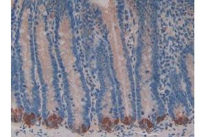 Image no. 2 for anti-Breast Cancer 2, Early Onset (BRCA2) (AA 2913-3151) antibody (ABIN5013248)