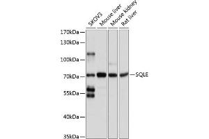 Western blot analysis of extracts of various cell lines, using SQLE antibody (ABIN1513563, ABIN5664074, ABIN5664075, ABIN5664076 and ABIN6219540) at 1:1000 dilution.