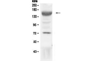 Image no. 1 for anti-Insulin-Like Growth Factor 1 Receptor (IGF1R) (AA 31-257) antibody (ABIN5519001)