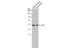 Image no. 2 for anti-Low Density Lipoprotein Receptor-Related Protein Associated Protein 1 (LRPAP1) (Center) antibody (ABIN2855752)