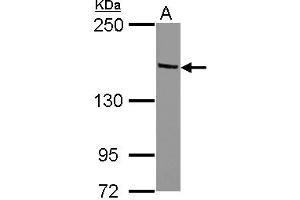 Image no. 1 for anti-Tripartite Motif Containing 24 (TRIM24) (AA 82-399) antibody (ABIN1501502)