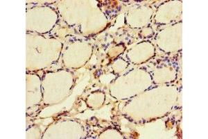 Immunohistochemistry of paraffin-embedded human thyroid tissue using ABIN7172419 at dilution of 1:100