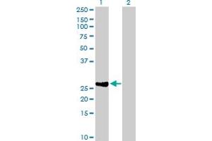 Image no. 1 for anti-DIRAS Family, GTP-Binding RAS-Like 2 (DIRAS2) (AA 1-199) antibody (ABIN527192)