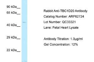 Image no. 1 for anti-TBC1 Domain Family, Member 20 (TBC1D20) (C-Term) antibody (ABIN2789226)