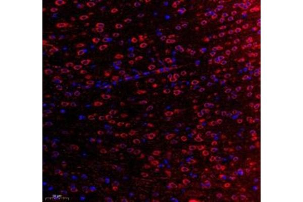 WDR81 antibody