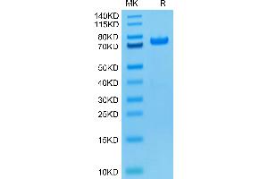 PAD4 Protein (His tag,Biotin)