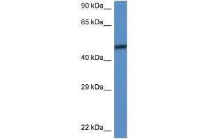 Image no. 1 for anti-SWI/SNF Related, Matrix Associated, Actin Dependent Regulator of Chromatin, Subfamily D, Member 3 (SMARCD3) (C-Term) antibody (ABIN2787637)