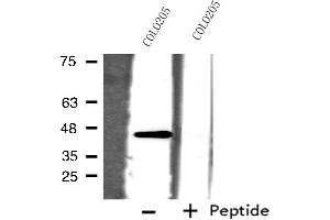 Image no. 2 for anti-Solute Carrier Family 22 Member 18 (SLC22A18) (C-Term) antibody (ABIN6258498)