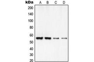 Image no. 2 for anti-Regulator of Chromosome Condensation 2 (RCC2) (C-Term) antibody (ABIN2705179)