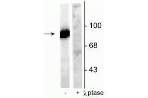 Image no. 2 for anti-Dynamin 1 (DNM1) (pSer778) antibody (ABIN361465)