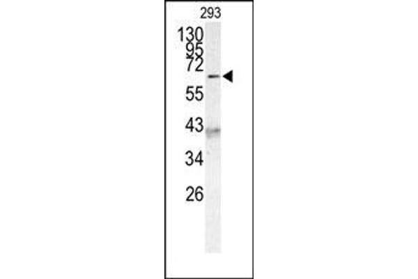 anti-Protein AF-9 (MLLT3) (C-Term) antibody