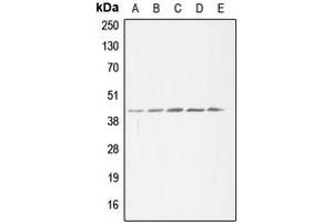 Image no. 2 for anti-Acetyl-CoA Acetyltransferase 1 (ACAT1) (Center) antibody (ABIN2705384)