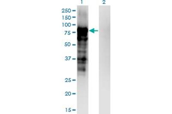 anti-Plakophilin 3 (PKP3) (AA 225-324) antibody