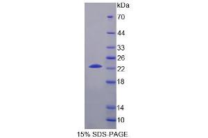 Image no. 1 for Choline Kinase beta (CHKB) protein (ABIN6119599)