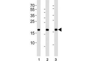 anti-High Mobility Group AT-Hook 2 (HMGA2) (N-Term) antibody