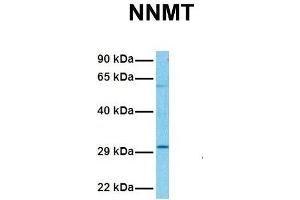 Image no. 2 for anti-Nicotinamide N-Methyltransferase (NNMT) (N-Term) antibody (ABIN2775335)