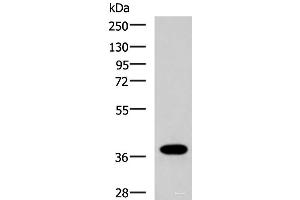 Western blot analysis of Human placenta tissue lysate using GPR6 Polyclonal Antibody at dilution of 1:1000