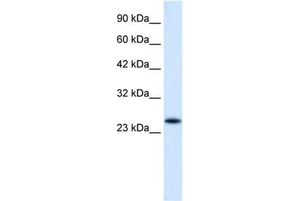anti-Charged Multivesicular Body Protein 3 (CHMP3) (N-Term) antibody