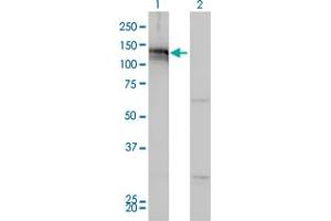 Image no. 2 for anti-AXL Receptor tyrosine Kinase (AXL) (AA 30-140) antibody (ABIN560017)